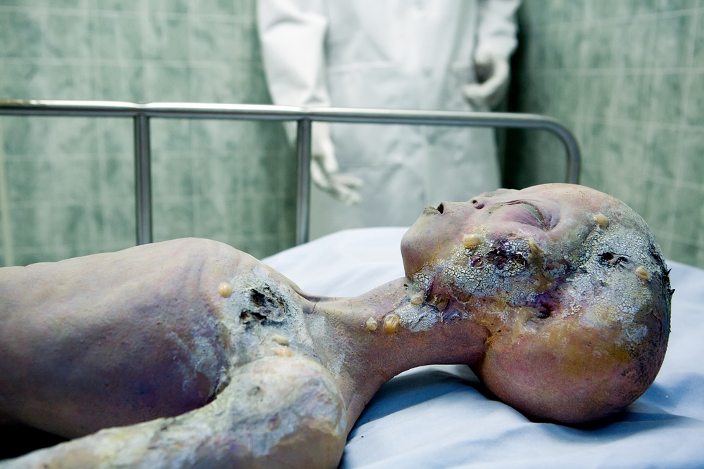 Roswell Alien Autopsy. 