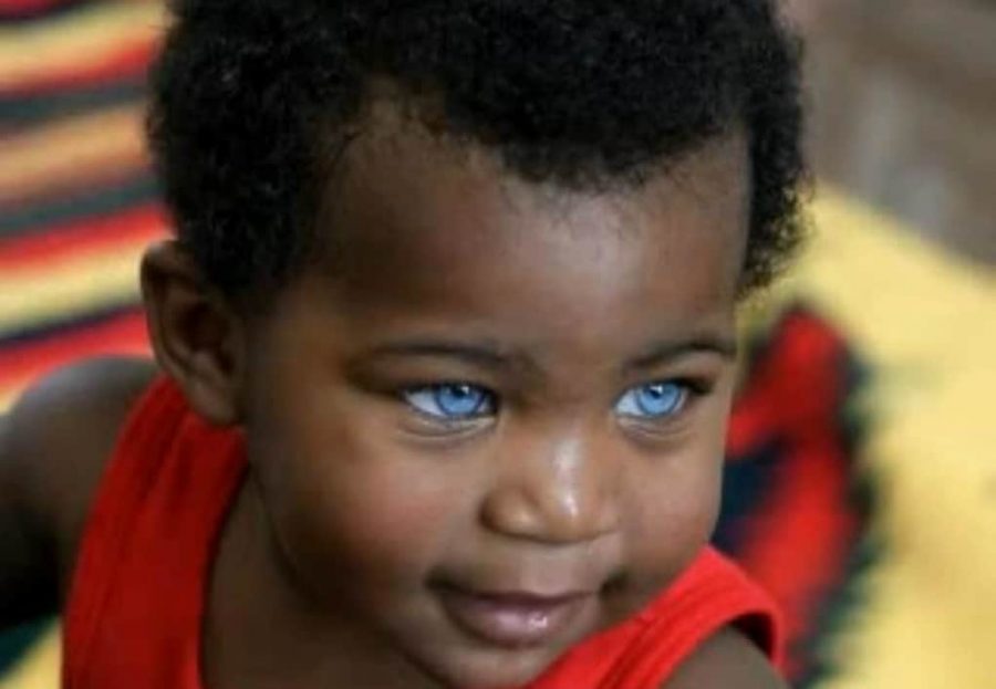 Black Africans with blue eyes